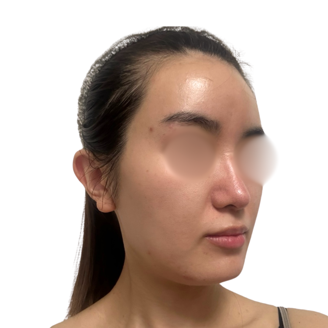 バイオリピール（ミラノリピール）